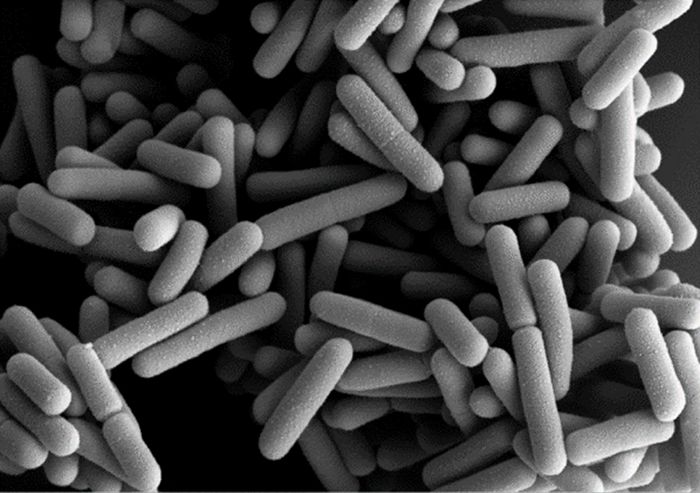 hy, 독자 개발한 특허 유산균 ‘HY2782’ 장 염증 예방 효능 입증... 국제학술지 게재