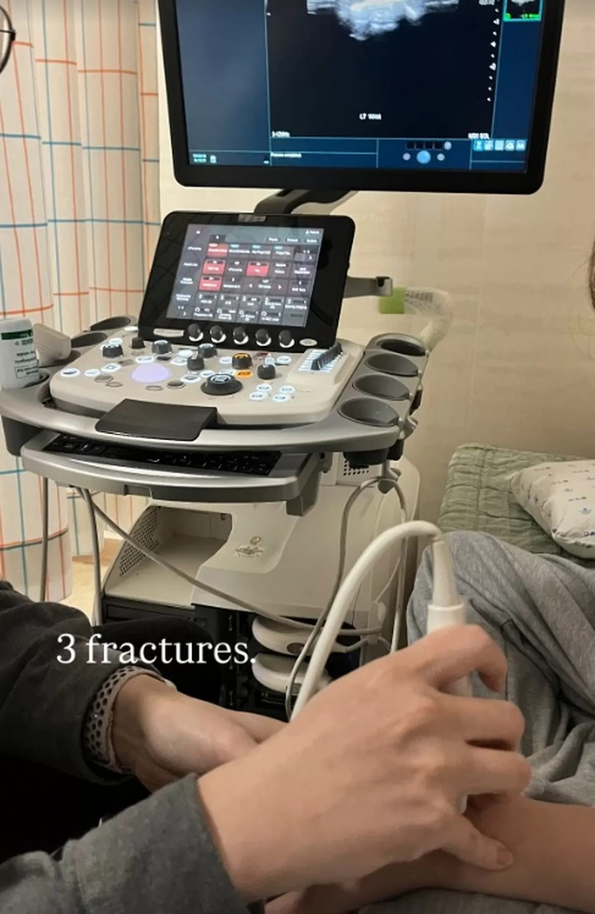 알고 보니 ‘부상 투혼’이었다... 3군데 골절에도 금메달 목에 건 최가온