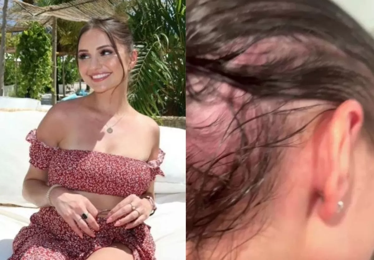 “머리 빠지고 피 토까지”... 에어컨 물 얼굴에 맞았다가 ‘살인 곰팡이’ 감염된 여성