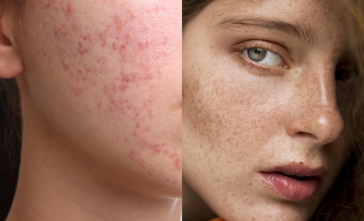 사진 = 동아제약