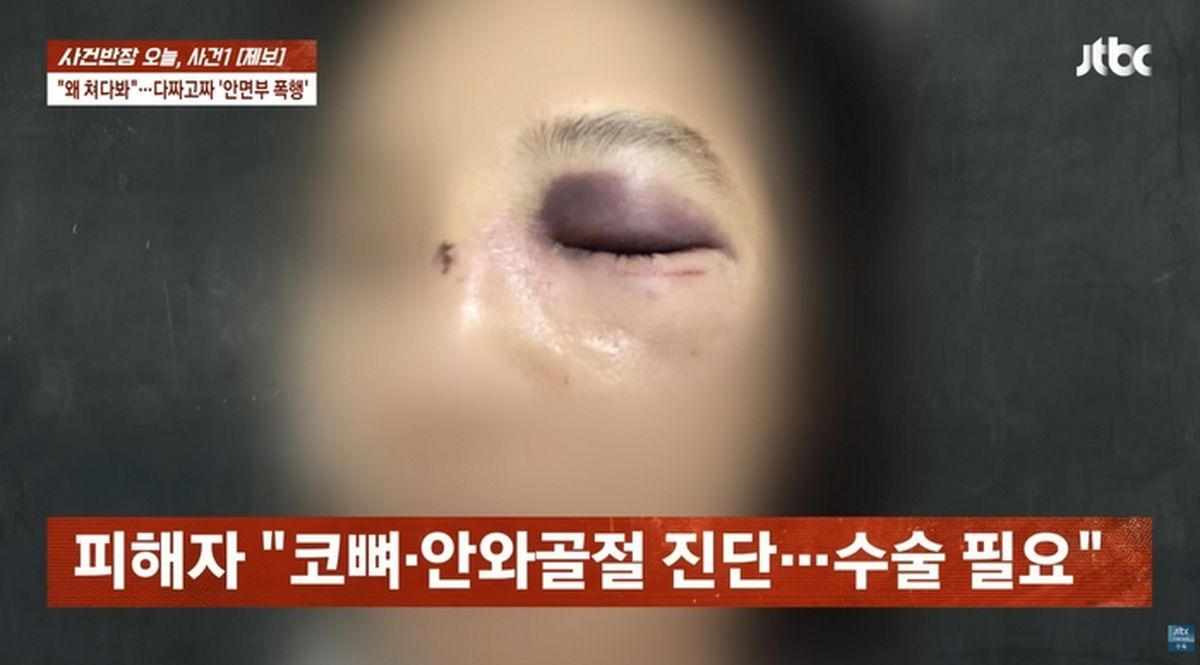 “얼굴 변해 여권 대조도 안 돼”... 세부서 한국인 일행에 집단 폭행당한 여행객 (영상)