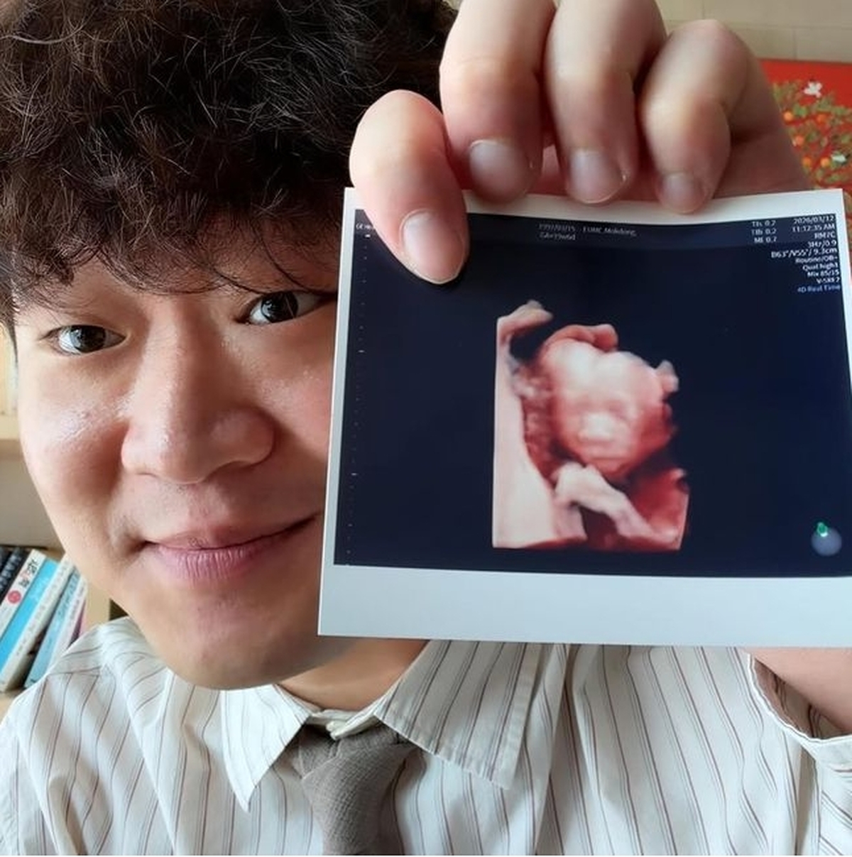 ‘피식대학’ 정재형, 결혼 5개월 만에 아빠 된다... 초음파 사진 공개