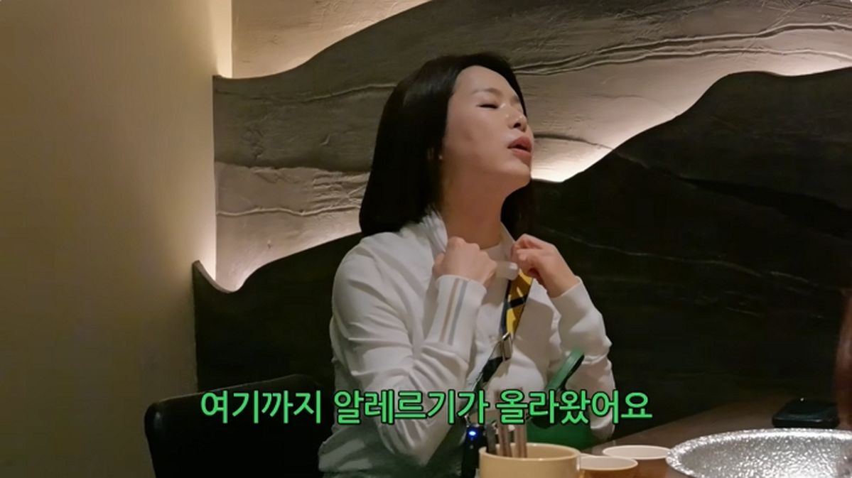 “예뻐지려다 그만” 김지선, 시술 부작용으로 목까지 뒤덮인 알레르기