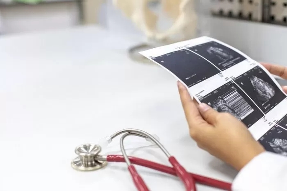 기사의 이해를 돕기 위한 자료사진 / gettyimagesBank
