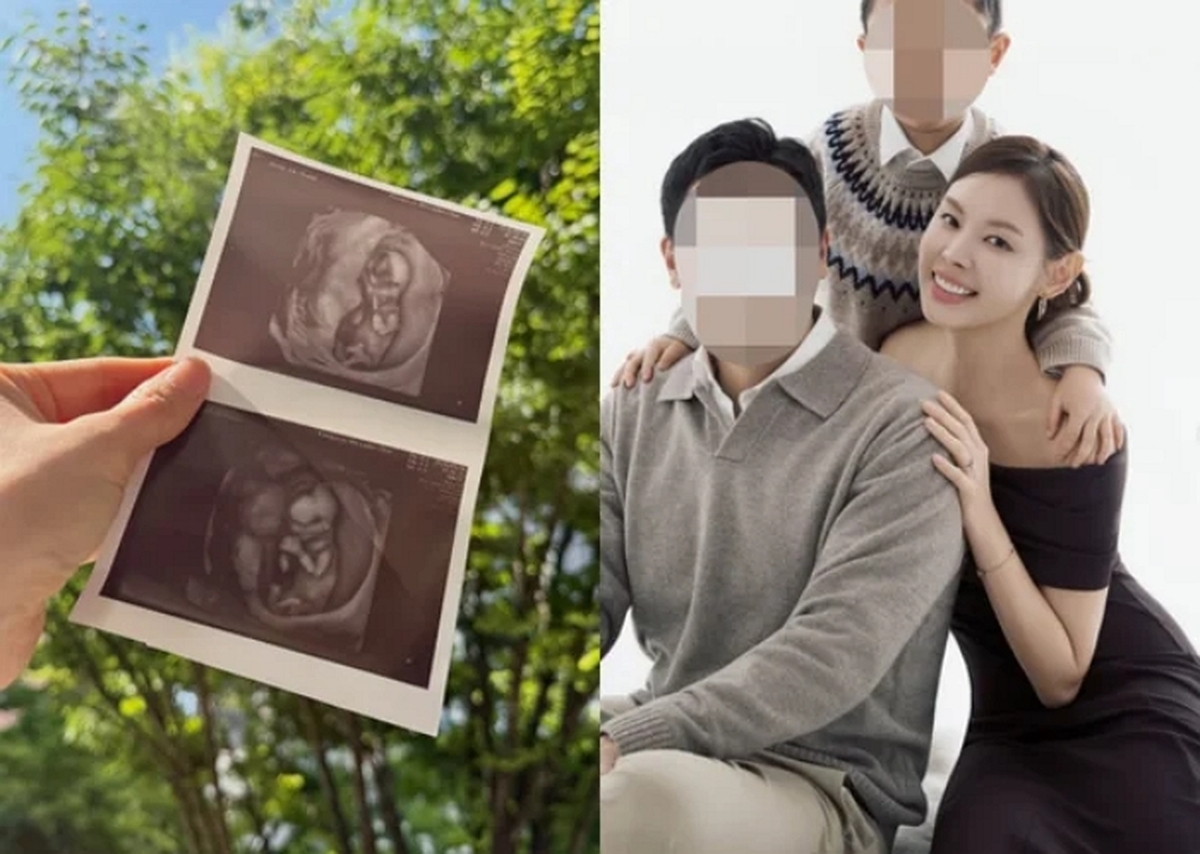 모델 출신 여배우, 40세에 둘째 자연 임신... 