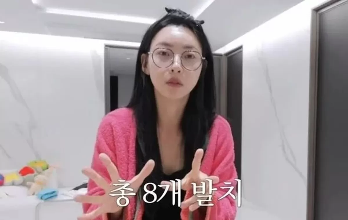 성형NO 김민지, &amp;quot;치아 8개 발치·교정만 4년&amp;quot;…하관 작아진 이유 [마데핫리뷰]