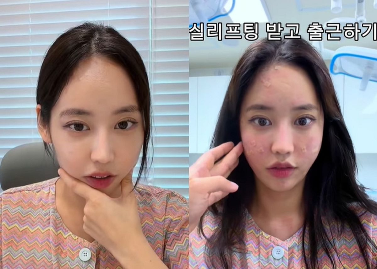 래퍼 육지담, 성형외과 상담실장 된 근황... 직접 시술까지 받았다