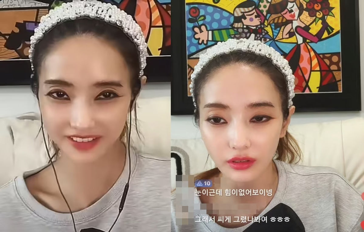한채영, 라방 중 확 달라진 비주얼... ‘건강 걱정’ 반응 이어져