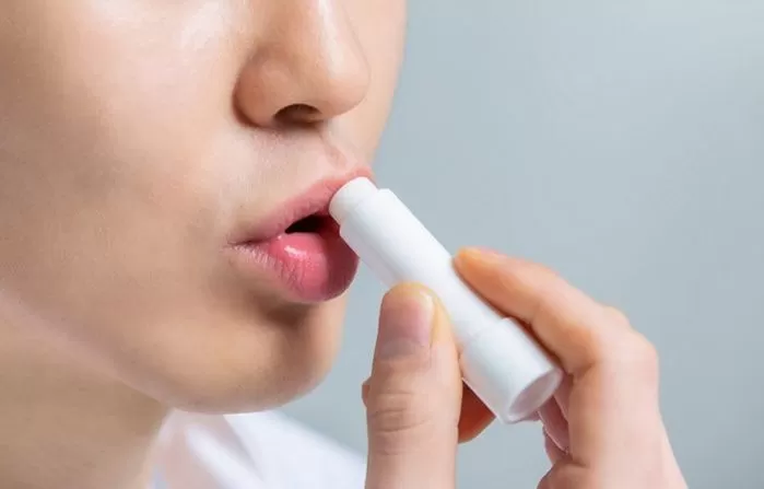 입술 껍질,입술 각질,립밤 추천,바세린 입술,탈락성 입술염