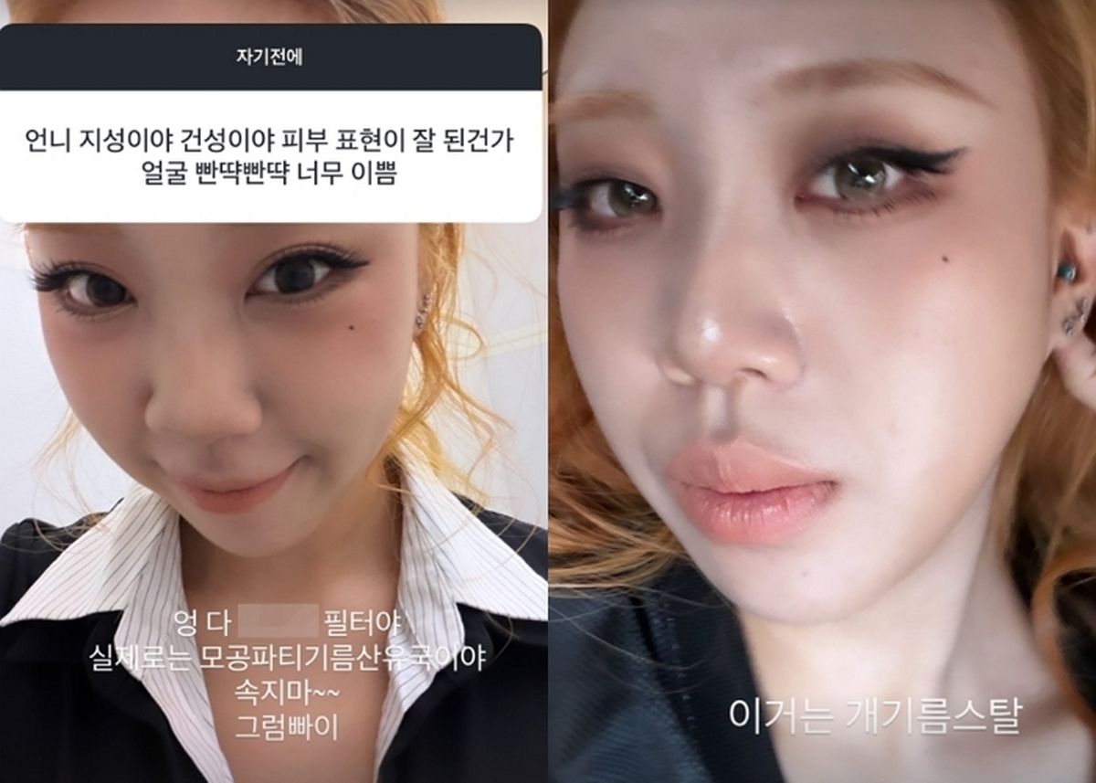 “다 필터야... 실제론 모공파티” 이영지, 꿀피부 질문에  ‘쿨내 진동’ 털털 답변