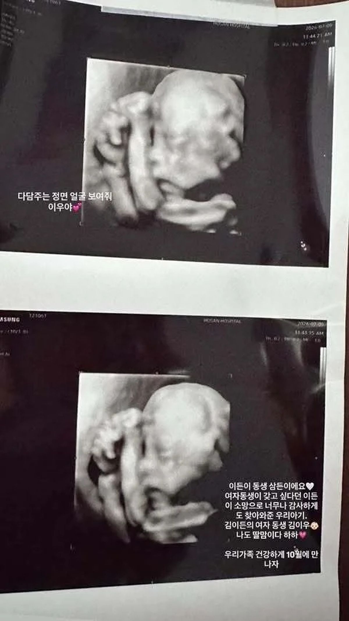 지드래곤, 또 조카 생겼다... 김민준♥권다미 둘째 임신, 성별 공개