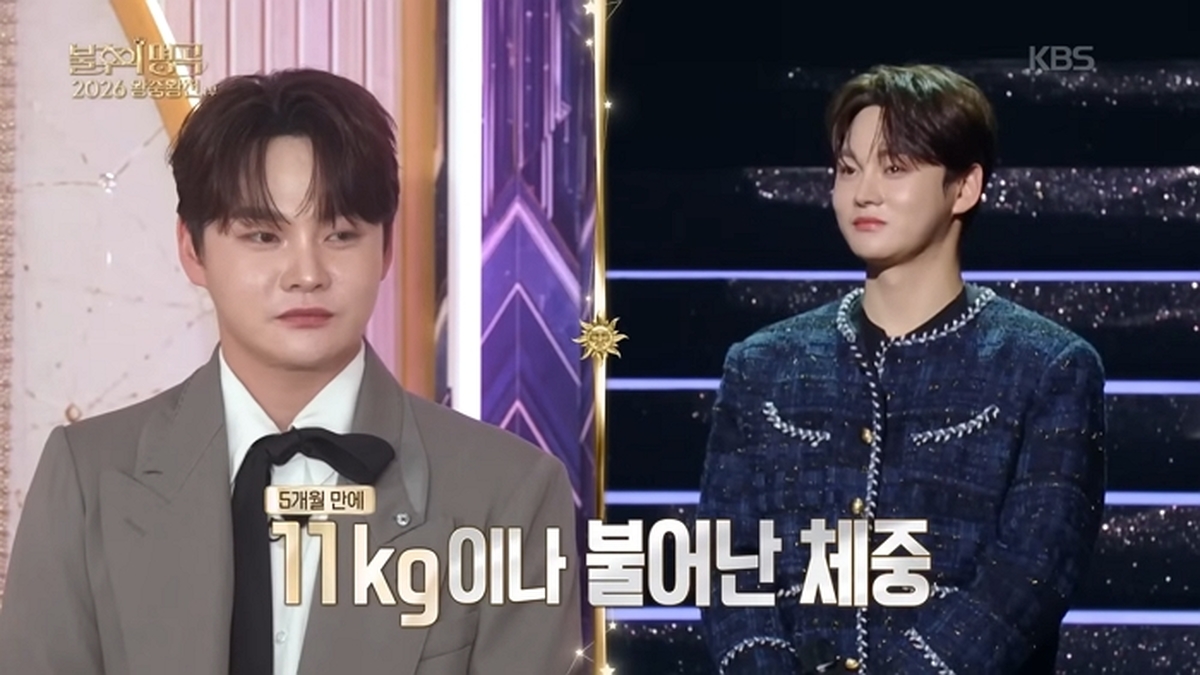 ‘1억 성형’ 박서진, 요요와서 11kg 쪘다... “왕중왕전 우승하면 시술·회복 휴가 받기로”