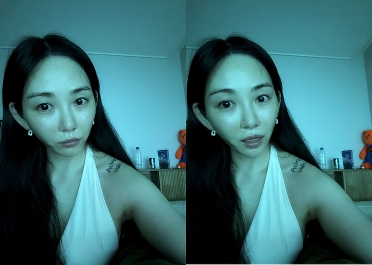 권민아, 리프팅 의료사고 후 근황... 한층 야윈 모습에 팬들 걱정