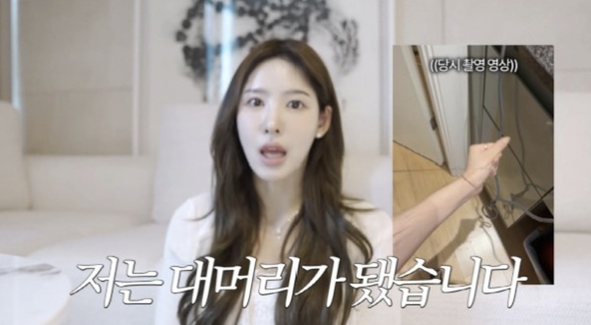 환승연애2 <b>이나연</b> 모발이식 부작용으로 탈모 "1cm 채우려다 30cm날아가"
