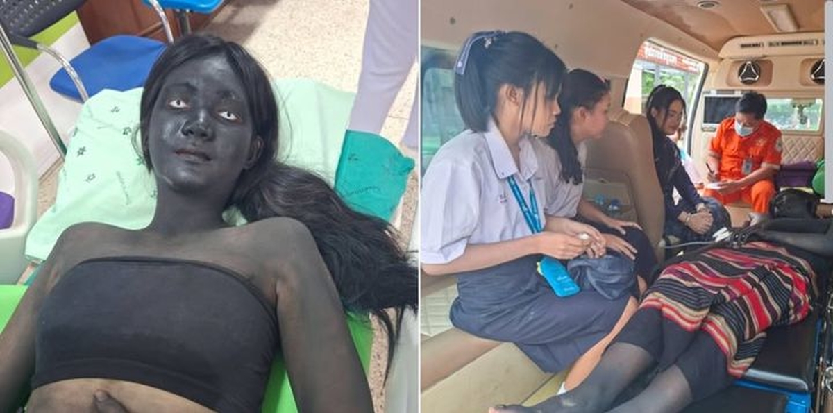 “구급대원도 보고 깜짝”... 귀신 분장한 채 응급실 실려간 여학생의 충격 비주얼