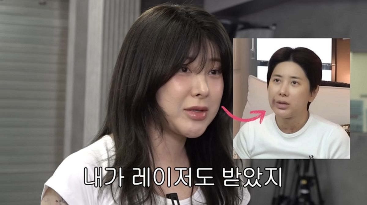 서인영, ‘워터밤’ 무대에 진심... 얼굴 레이저·팔뚝 지방흡입하고 달라졌다