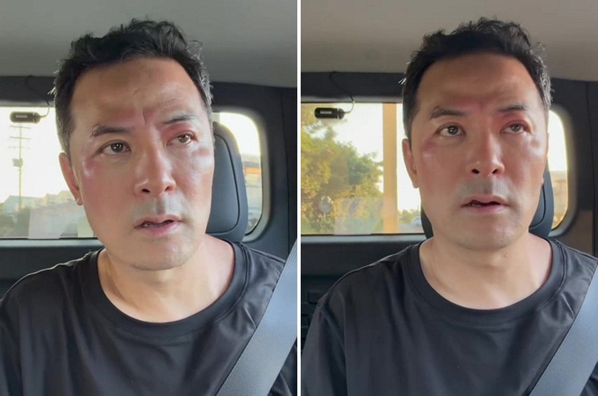 김창옥, 퉁퉁 붓고 빨갛게 부은 얼굴... “무슨 일이냐” 팬들 걱정
