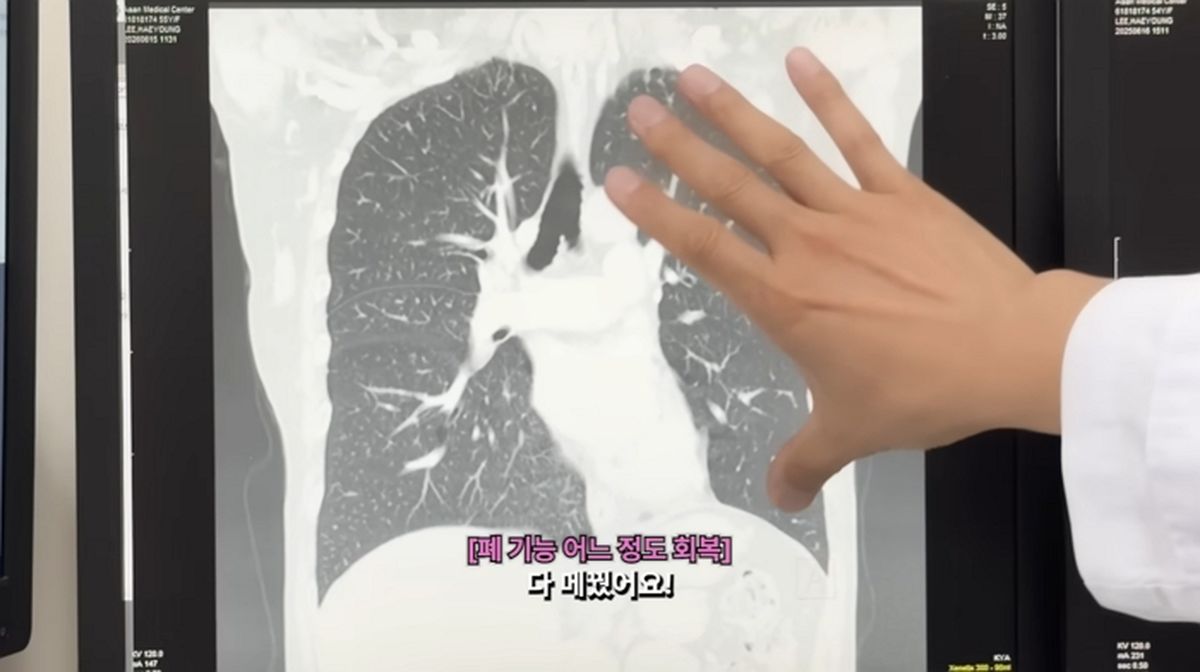 ‘폐암 투병’ 이혜영, 母와 하루 차이로 암 진단... 가족도 몰랐던 고백