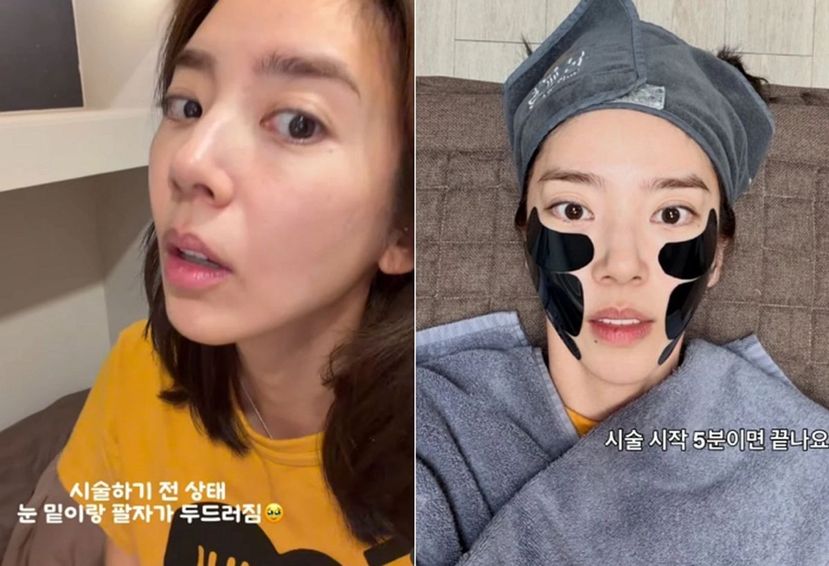 ‘리프팅 시술 고백’ 손담비, 민낯 자신감