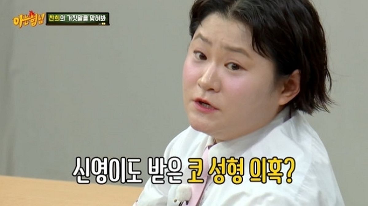 “댓글 보고 깜짝”... 김신영, 갑자기 높아진 코 때문에 성형 오해받은 사연