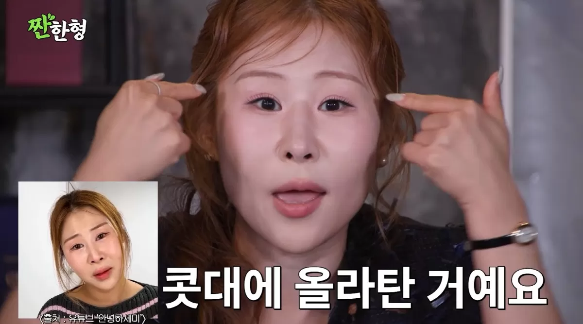 서준맘 박세미, 또 달라진 얼굴..코 재수술 후 눈 몰려 앞트임 복원