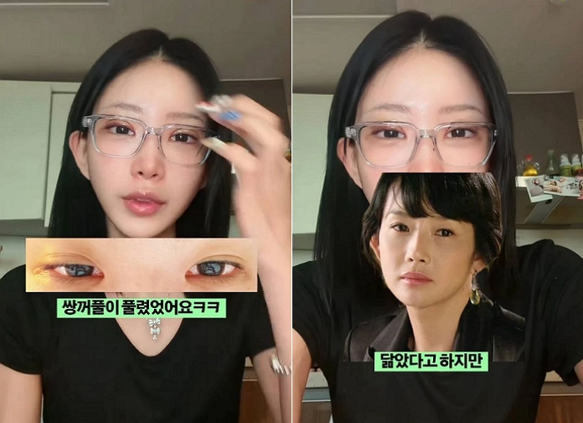최준희 “인생 한 번 사는데 최고 버전으로... 아직 수술 리스트 남아”