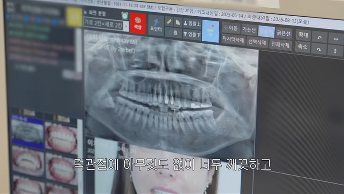 기존 이미지