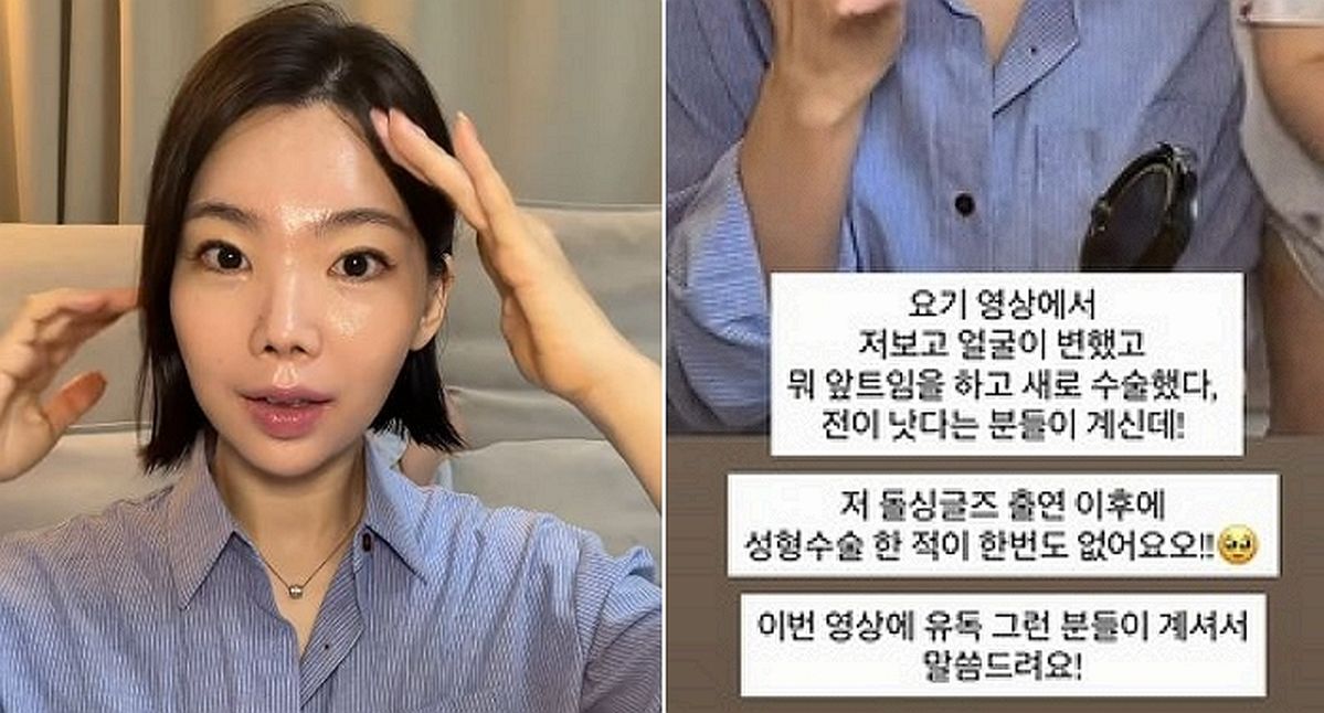 “앞트임 했다고?”... ‘윤남기♥’ 이다은, 성형 의혹에 결국 입장 내놨다