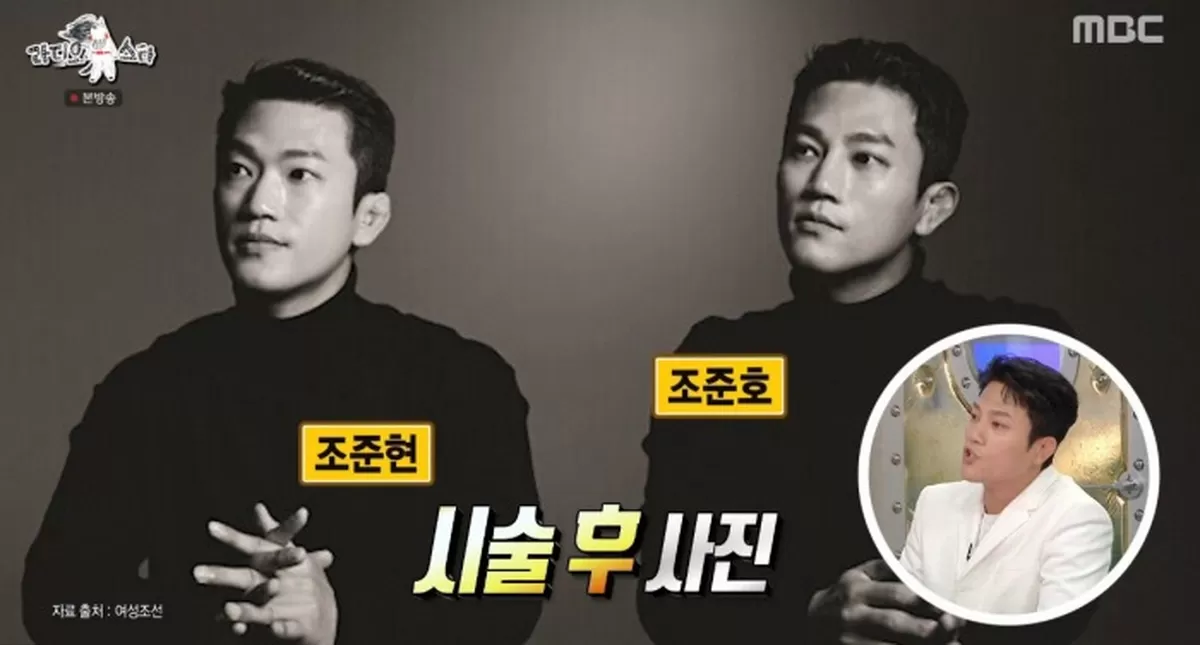 조준호, 어떤 시술했길래... “쌍둥이 남동생과 휴대폰 안면인식 안 돼”
