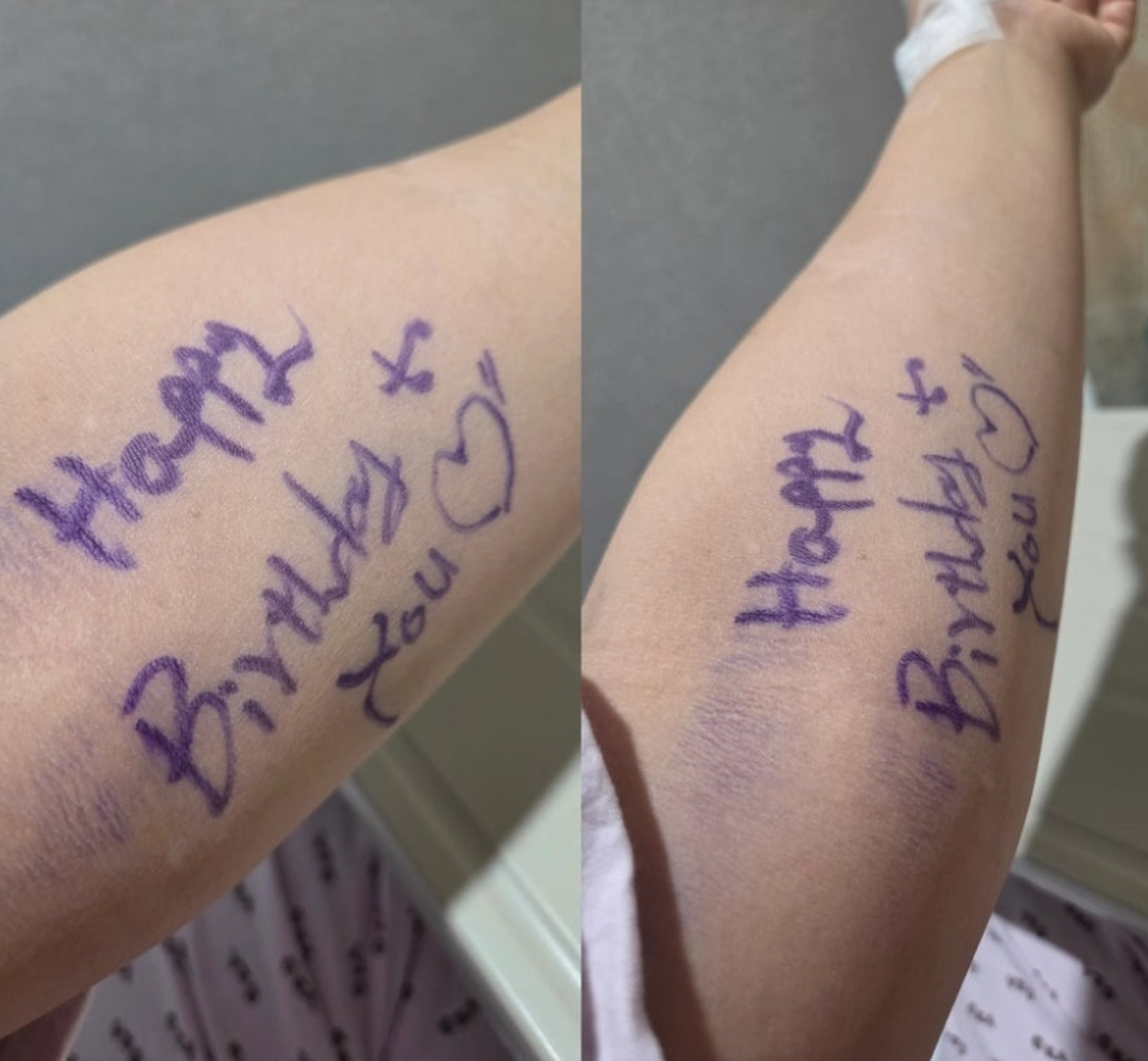 생일에 암 수술 받은 환자, 팔에서 발견한 ‘깜짝 메시지’에 눈물 펑펑... 뭉클한 후일담